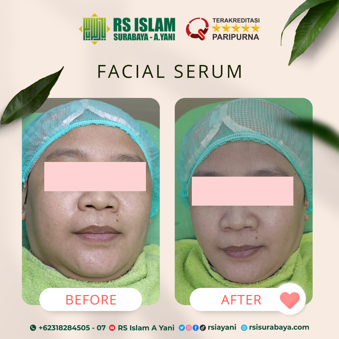 Facial-serum.png