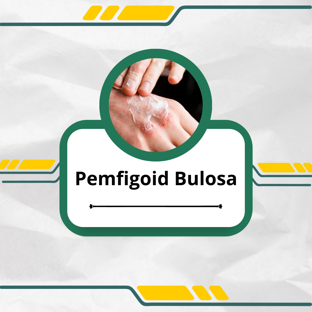 Pemfigoid-Bulosa-artikel-thumb.png