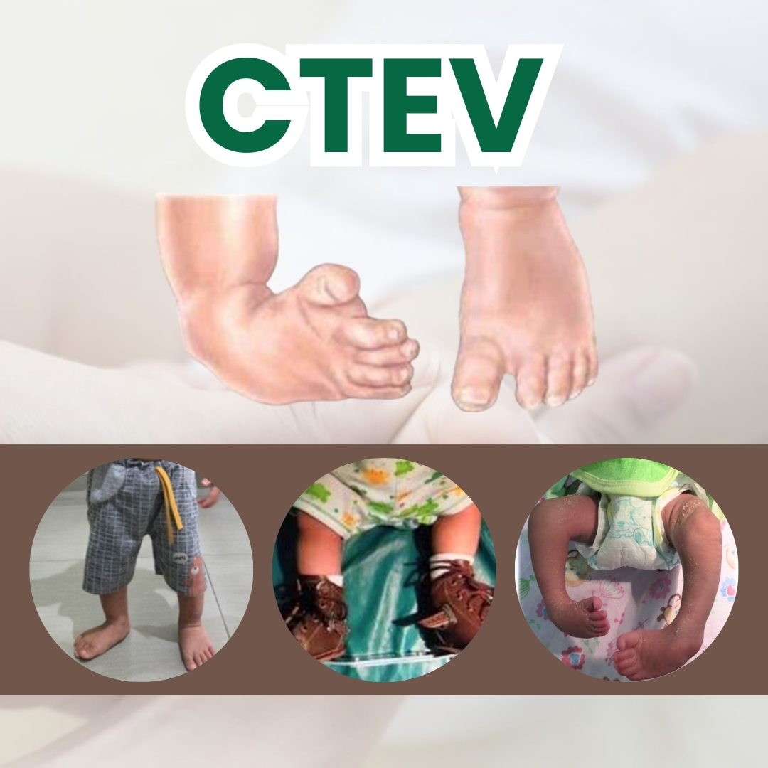 ctev-anak.jpg