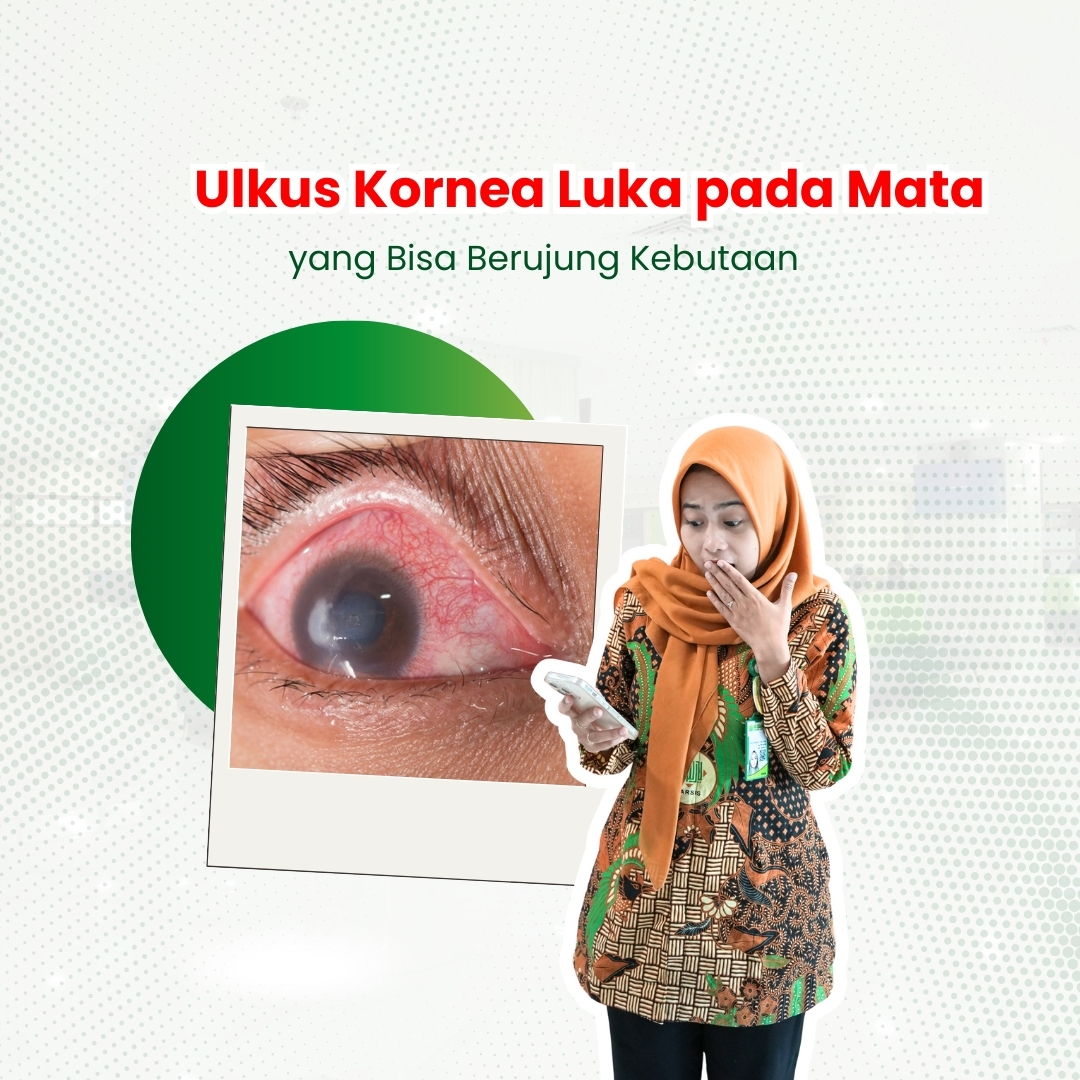 Ulkus-Kornea-Luka-pada-Mata-yang-Bisa-Berujung-Kebutaan.jpeg