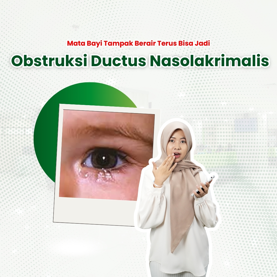 Mata-Bayi-Tampak-Berair-Terus-Bisa-Jadi-Obstruksi-Ductus-Nasolakrimalis.jpeg
