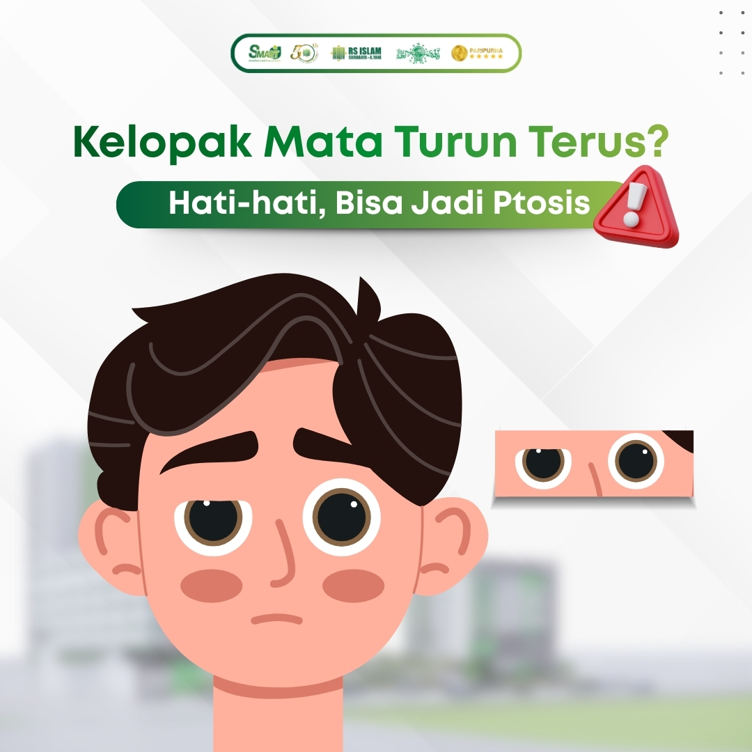 kelopak-mata-turun.jpeg