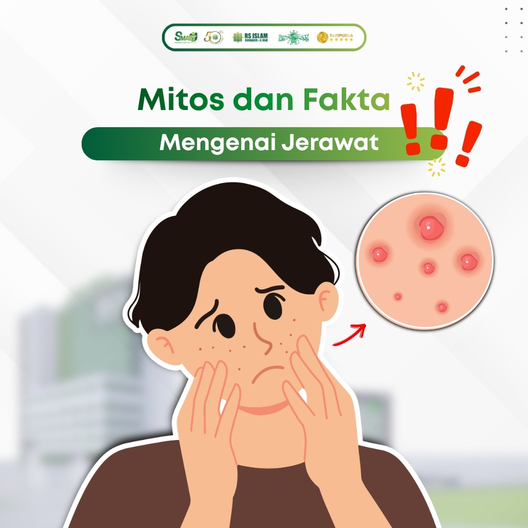 mitos-dan-fakta-mengenai-jerawat.jpeg