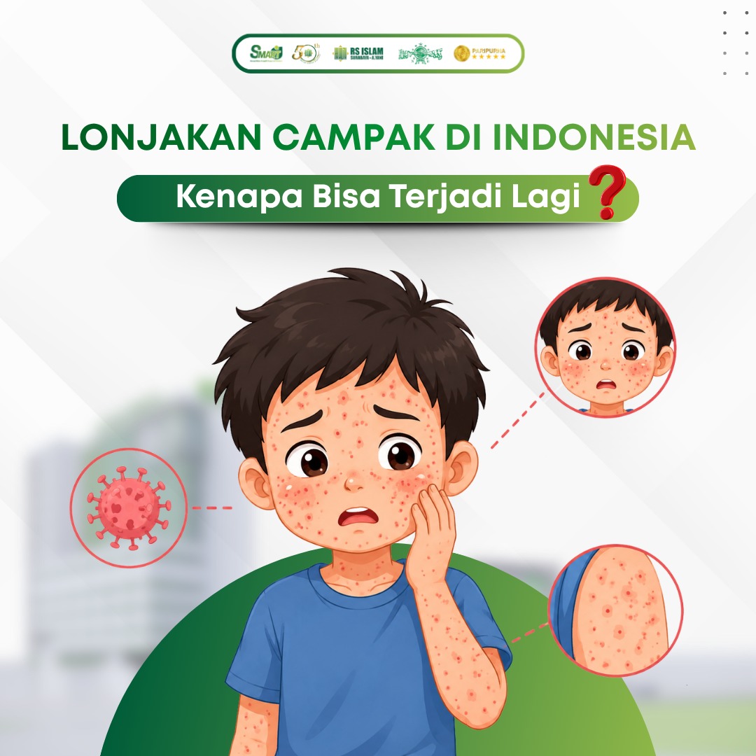 Lonjakan-campak-di-indonesia.jpeg