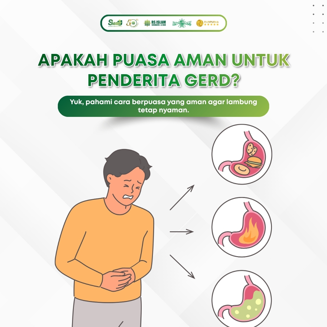 Apakah-Puasa-Aman-untuk-Penderita-GERD.jpg.jpeg