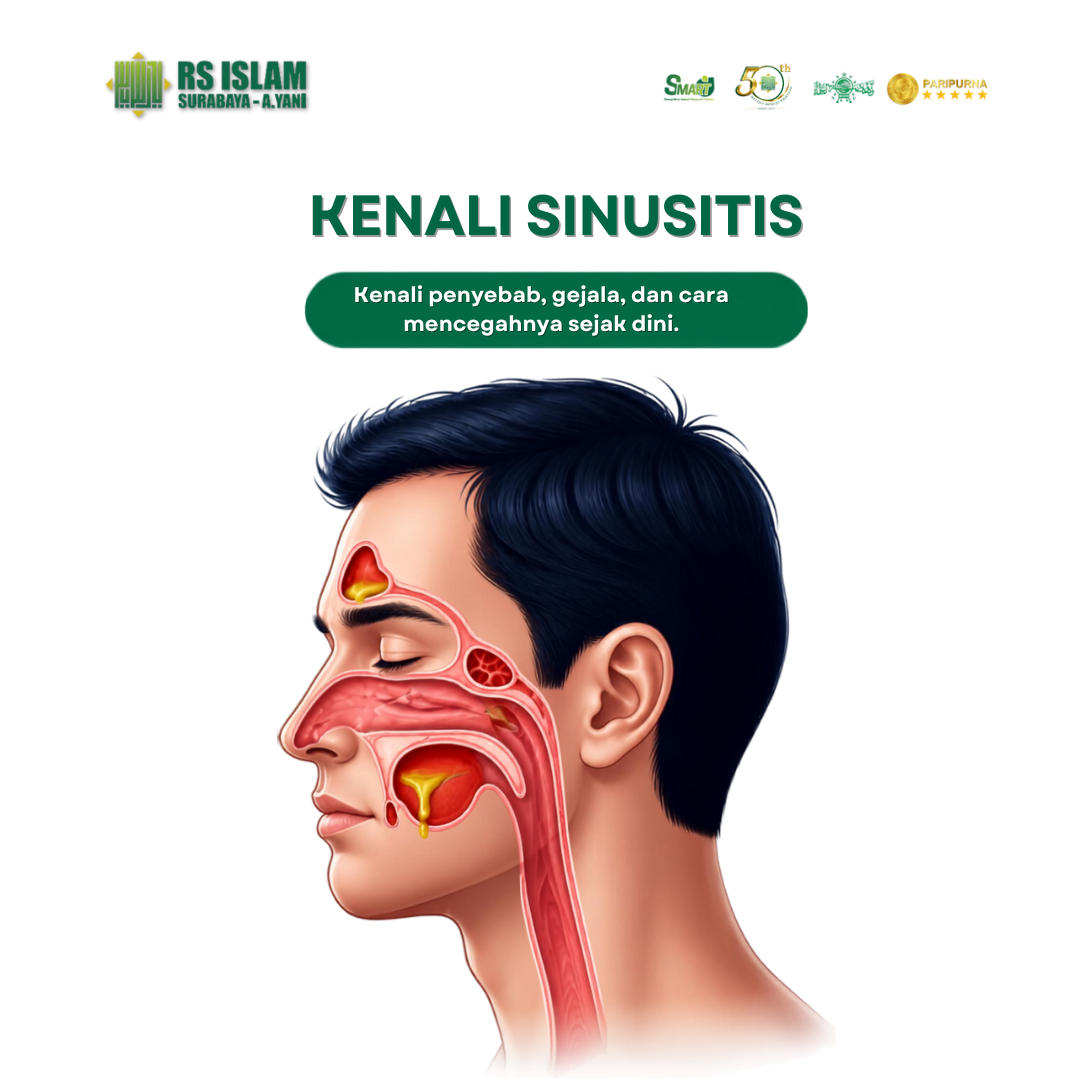 KENALI-SINUSITIS.png